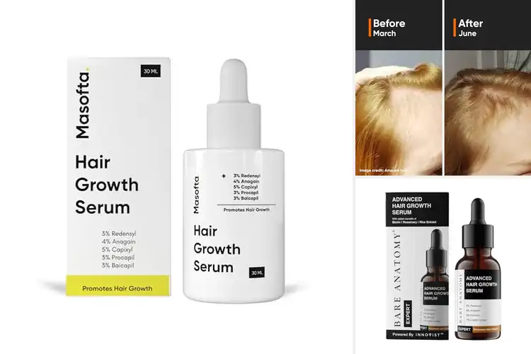 Detailed view of Best Redensyl Hair Products: Transform Your Hair Today