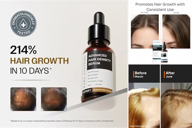 Detailed view of Best Redensyl-Infused Hair Products